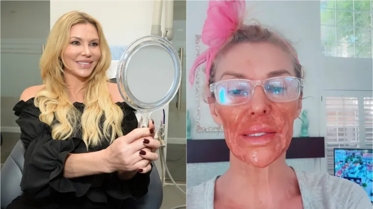 Biv&scaron;a manekenka proživjela horor pa otkrila &scaron;to joj je uni&scaron;tilo lice