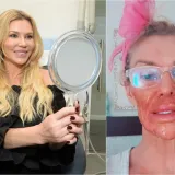 Biv&scaron;a manekenka proživjela horor pa otkrila &scaron;to joj je uni&scaron;tilo lice