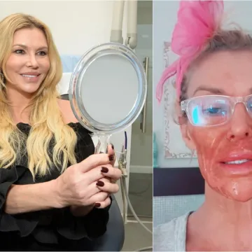 Biv&scaron;a manekenka proživjela horor pa otkrila &scaron;to joj je uni&scaron;tilo lice