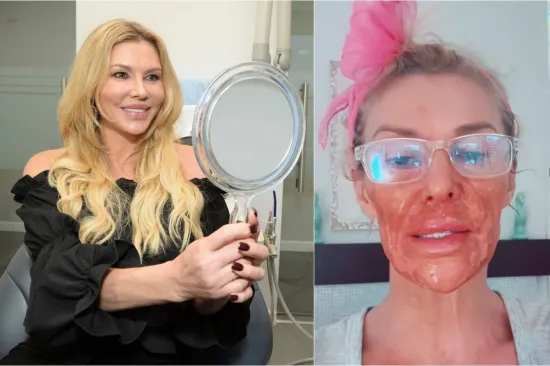 Biv&scaron;a manekenka proživjela horor pa otkrila &scaron;to joj je uni&scaron;tilo lice