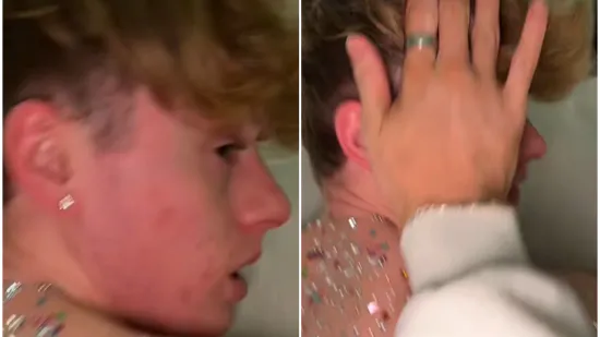 Dečko joj je spavao, a ona je odlučila unakaziti mu leđa