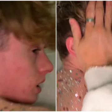 Dečko joj je spavao, a ona je odlučila unakaziti mu leđa