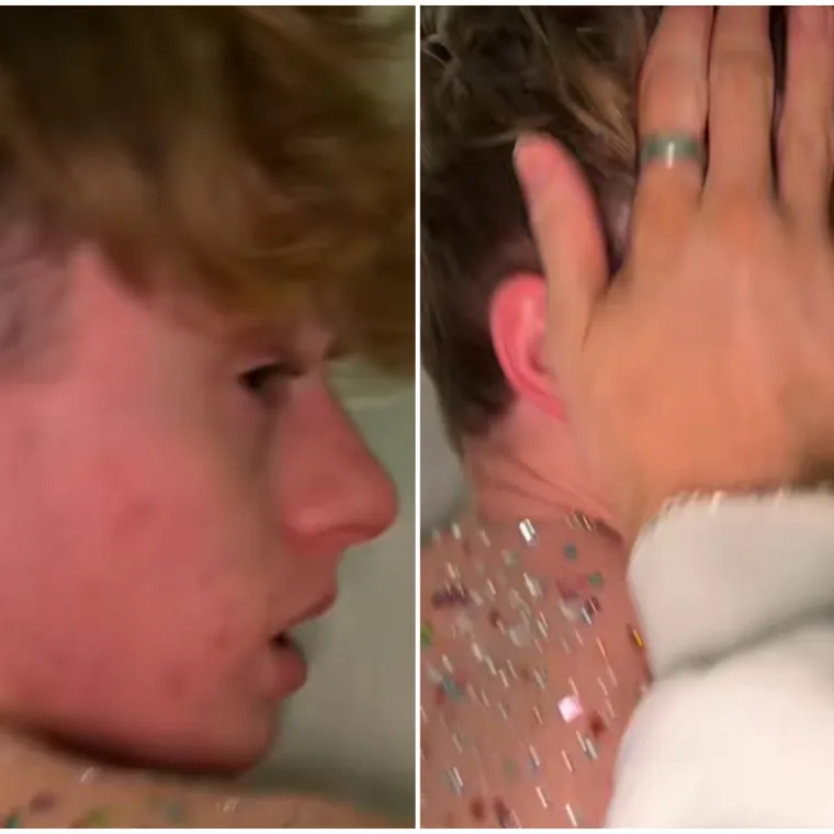 Dečko joj je spavao, a ona je odlučila unakaziti mu leđa