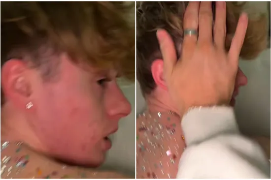 Dečko joj je spavao, a ona je odlučila unakaziti mu leđa