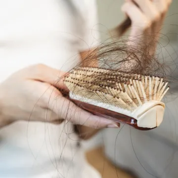 Liječnica mislila da gubi kosu zbog stresa: 'Rad sa ženama potaknuo me da provjerim svoju krv'