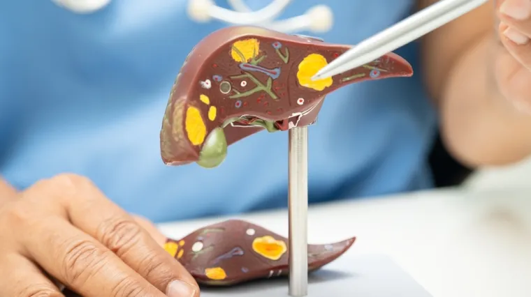 Bolesti jetre pogađaju do trećine odraslih u Hrvatskoj: Vodeći je uzrok smrtnosti