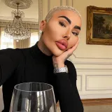 Preminuo influencer kojeg su nazivali 'Kralj usana': Na izgled je potro&scaron;io 150.000 dolara