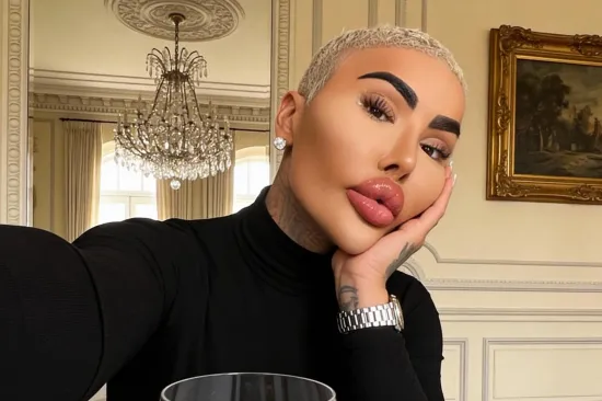 Preminuo influencer kojeg su nazivali 'Kralj usana': Na izgled je potro&scaron;io 150.000 dolara