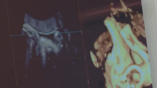 Sa 16 godina dobila zastra&scaron;ujuću dijagnozu: Liječnici izveli čudo - postala je majka!