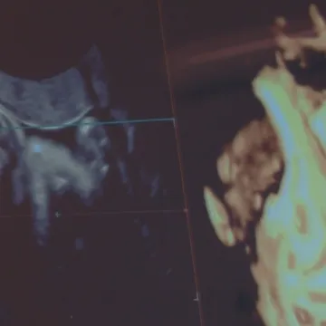 Ona je sa 16 godina dobila stra&scaron;nu dijagnozu: Liječnici su izveli čudo - postala je majka!