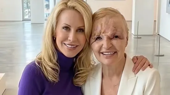 Cijena promjena: Slavne osobe nekoć i danas