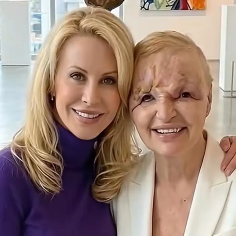 Cijena promjena: Slavne osobe nekoć i danas