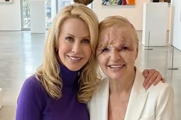 Cijena promjena: Slavne osobe nekoć i danas