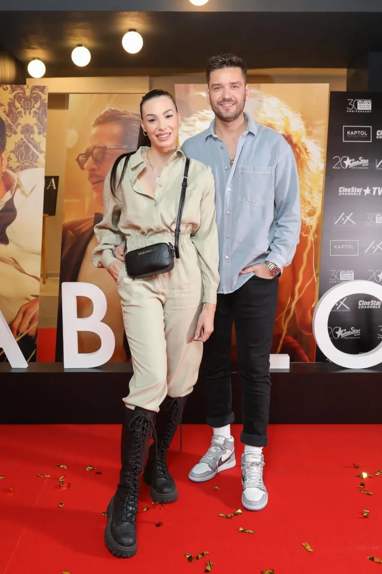 Sandi Pego oti&scaron;ao na transplantaciju kose u Tursku pa pokazao kako je to izgledalo