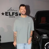 Sandi Pego oti&scaron;ao na transplantaciju kose u Tursku pa pokazao kako je to izgledalo