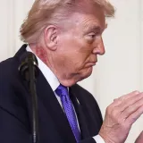 &Scaron;to je to na vratu Donalda Trumpa? 'Predsjednik koristi tretman'