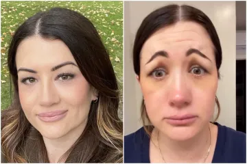 Htjela je ljep&scaron;e čelo, a umjesto toga prestra&scaron;ila vlastitog zaručnika: 'Otrčala sam'