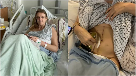 Liječnici su ignorirali njene simptome punih sedam godina: 'Slu&scaron;ajte tijelo i tražite pretrage'