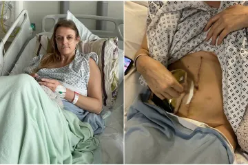 Liječnici su ignorirali njene simptome punih sedam godina: 'Slu&scaron;ajte tijelo i tražite pretrage'