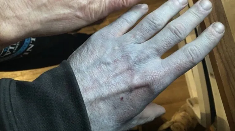 Probudio se plav poput &scaron;trumpfa, cijela bolnica i u ovom trenutku priča o njegovu slučaju