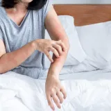 Muči vas noćni svrbež? Stručnjaci analiziraju: 'Možda zvuči ludo, ali doista djeluje'