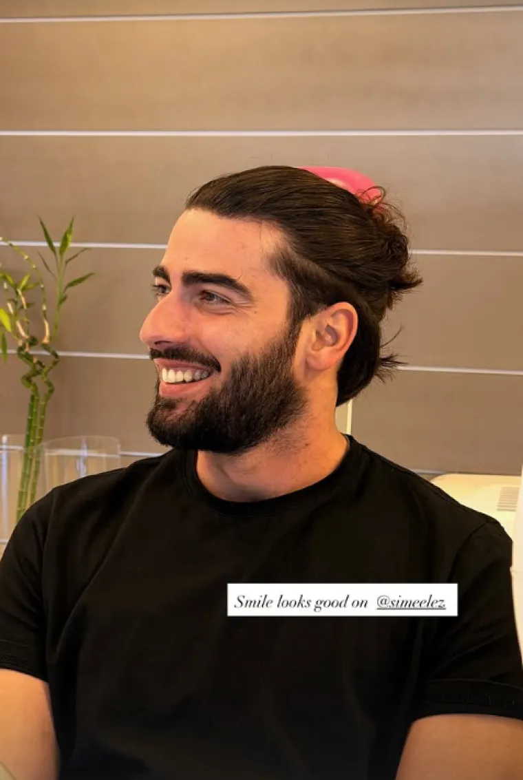 &Scaron;ime Elez podlegao trendu i pohvalio se makeoverom na licu