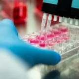 Testovi krvi koji vide rak prije simptoma: Velika su prekretnica, ali ima jedna kvaka