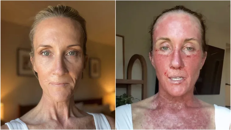 Doživjela je pravu noćnu moru, probudila se za vrijeme operacije: 'Bilo je zastra&scaron;ujuće'