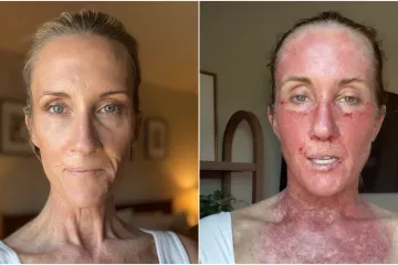 Doživjela je pravu noćnu moru, probudila se za vrijeme operacije: 'Bilo je zastra&scaron;ujuće'