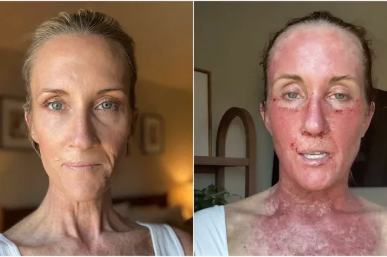 Doživjela je pravu noćnu moru, probudila se za vrijeme operacije: 'Bilo je zastra&scaron;ujuće'