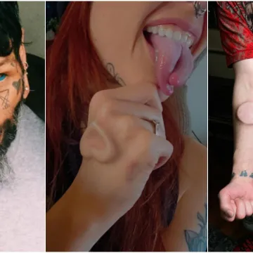 Ljudi su podijelili svoje najbizarnije modifikacije na tijelu: Neke su ba&scaron; zastra&scaron;ujuće
