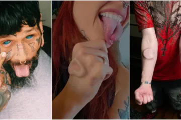 Ljudi su podijelili svoje najbizarnije modifikacije na tijelu: Neke su ba&scaron; zastra&scaron;ujuće