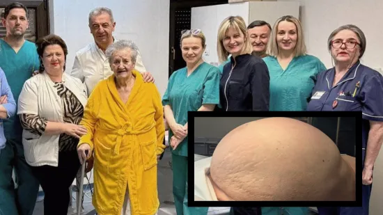 Liječnici su joj izvadili ogroman tumor: Ana (81) iz bolnice izlazi lak&scaron;a za 36 kg