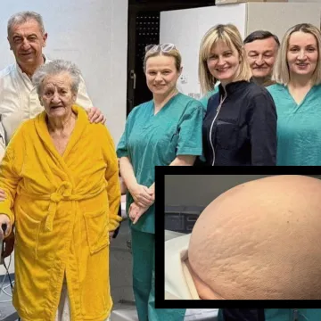 Liječnici su joj izvadili ogroman tumor: Ana (81) iz bolnice izlazi lak&scaron;a za 36 kg