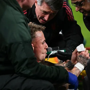 Stravična ozljeda zvijezde Galatasarayja, svijet u &scaron;oku: 'Prst mu je gotovo odrezan'