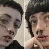 Najteži period u životu doveo je do ekstremnog zahvata: Evo kako danas izgleda