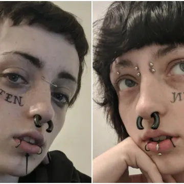 Najteži period u životu doveo je do ekstremnog zahvata: Evo kako danas izgleda