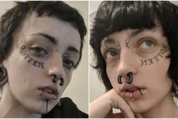 Najteži period u životu doveo je do ekstremnog zahvata: Evo kako danas izgleda