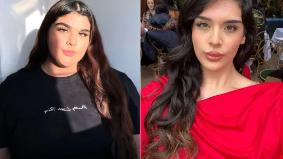 Smr&scaron;avjela 40 kilograma, no hejteri je zlostavljaju: 'Optužuju me da koristim injekcije'