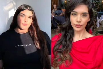 Smr&scaron;avjela 40 kilograma, no hejteri je zlostavljaju: 'Optužuju me da koristim injekcije'