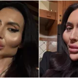 Ponosno nosi titulu žene s najvećim obrazima: Prije je bila prava ljepotica, evo kako je izgledala