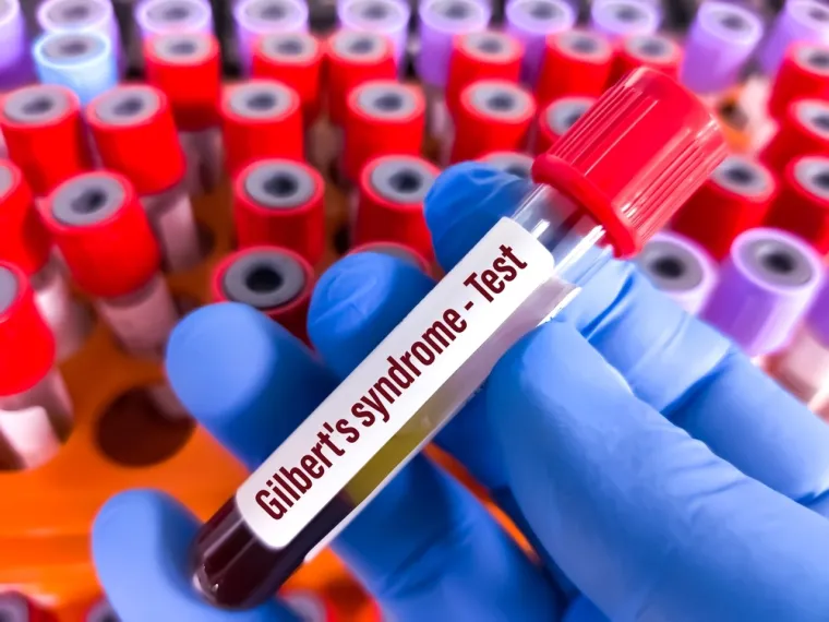 Liječnik Bekić o sindromu za koji mnogi niti ne znaju da ga imaju: 'Če&scaron;će zahvaća mu&scaron;karce'