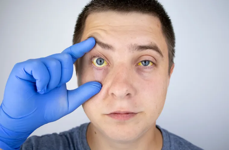 Liječnik Bekić o sindromu za koji mnogi niti ne znaju da ga imaju: 'Če&scaron;će zahvaća mu&scaron;karce'