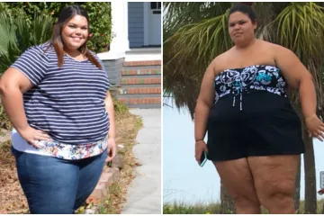 Sa samo 20 godina težila je 145 kilograma, no izokrenula je navike i danas je neprepoznatljiva