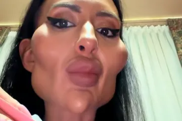 Žena je s najvećim obrazima na svijetu