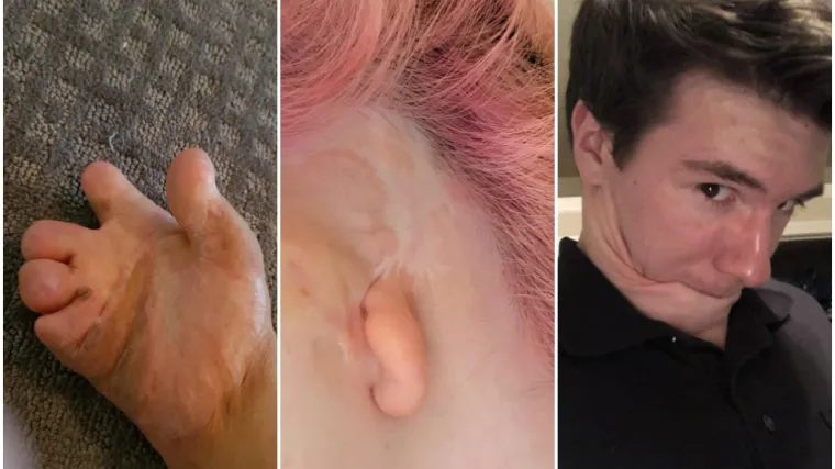 Ovi ljudi rođeni su da bi se isticali u gomili: Njihove anomalije doista su nevjerojatne