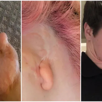 Ovi ljudi rođeni su da bi se isticali u gomili: Njihove anomalije doista su nevjerojatne