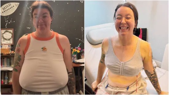 Godinama je patila zbog golemih grudi: 'Na kraju sam nosila vi&scaron;e grudnjaka odjednom'