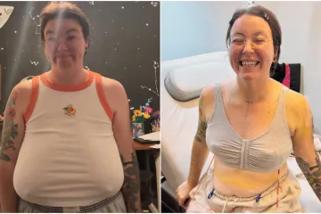 Godinama je patila zbog golemih grudi: 'Na kraju sam nosila vi&scaron;e grudnjaka odjednom'