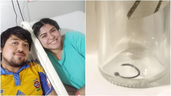 Piercing joj zavr&scaron;io u plućima na pola milimetra od aorte: 'Užas koji ne bih poželjela nikome'